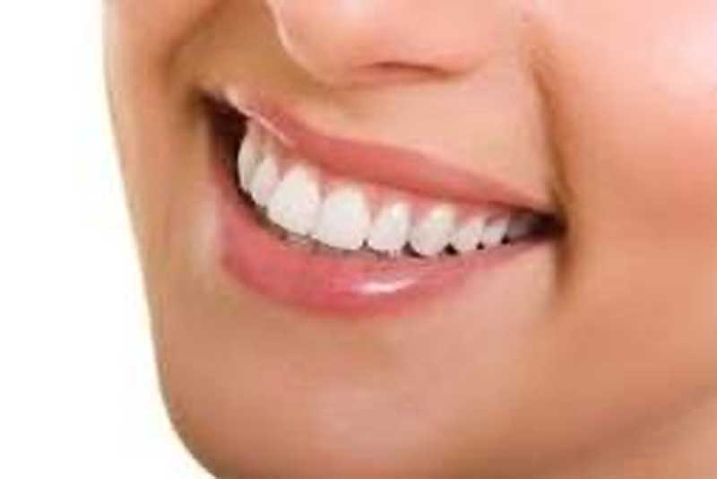 Teeth Whitening