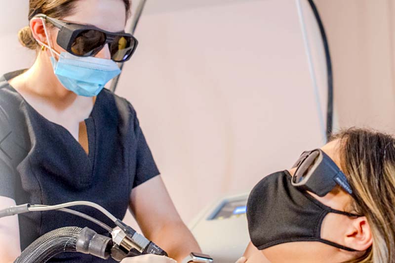 Cynosure Laser Hair Removal