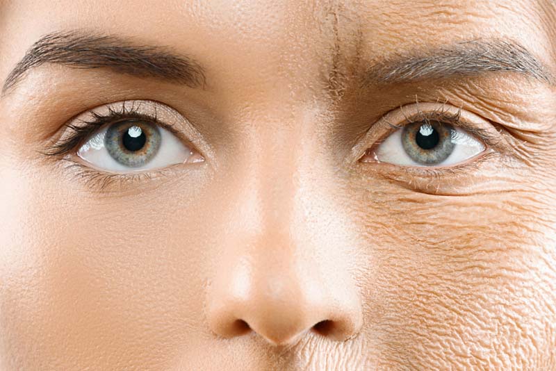 Smoothing out tired and aging skin